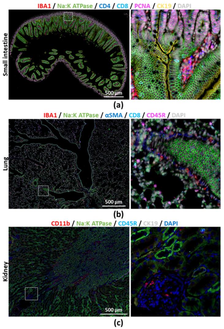 https://cdn.ncbi.nlm.nih.gov/pmc/blobs/4a75/7565194/9d0a7de55668/cancers-12-02449-g003.jpg