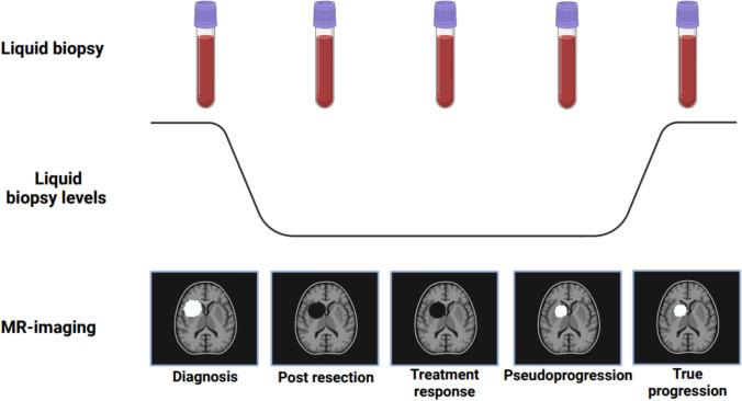 https://cdn.ncbi.nlm.nih.gov/pmc/blobs/4ceb/12033197/2b3359dbe1a3/401_2025_2880_Fig2_HTML.jpg