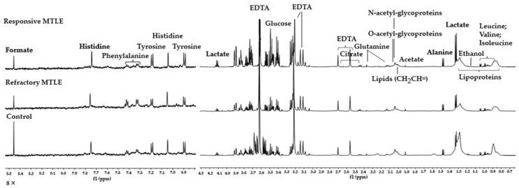 https://cdn.ncbi.nlm.nih.gov/pmc/blobs/4f51/9148034/932cb7d622fc/metabolites-12-00446-g001.jpg
