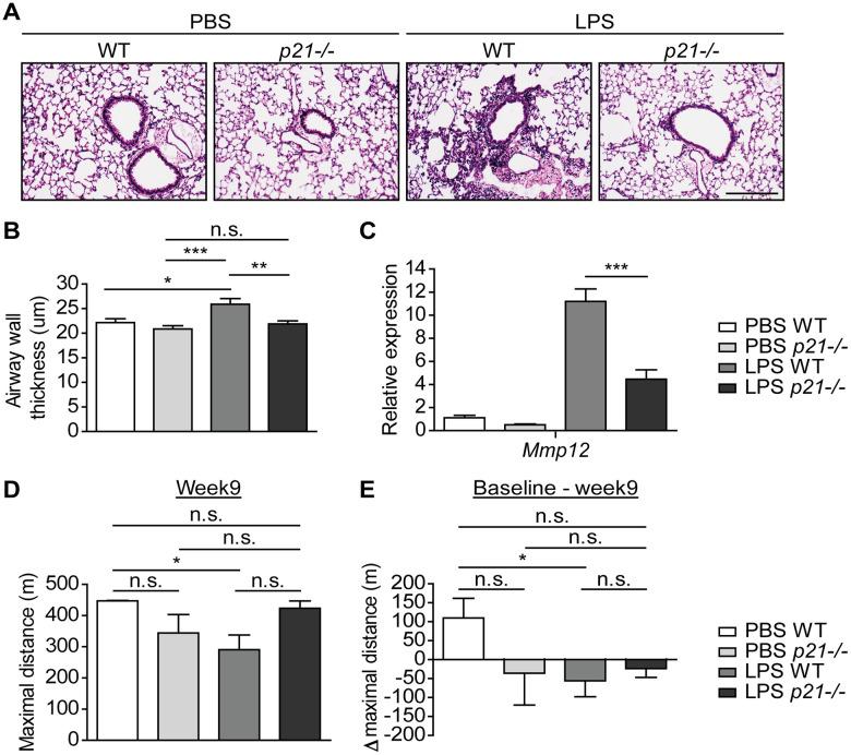 https://cdn.ncbi.nlm.nih.gov/pmc/blobs/51fe/10120903/1874fc30d255/aging-15-204622-g002.jpg