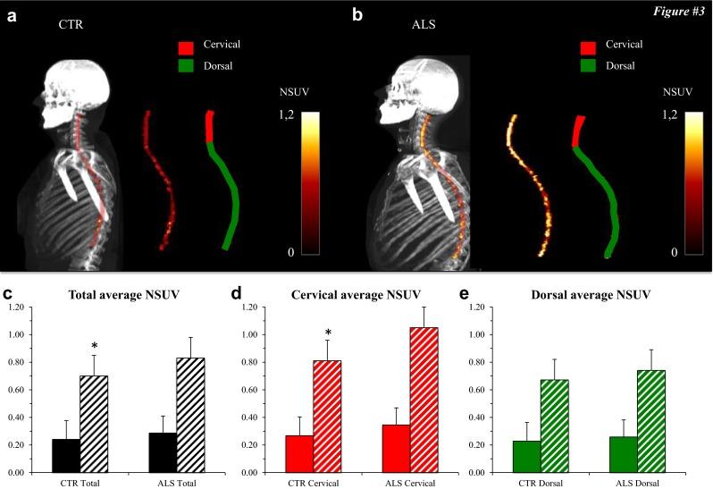 https://cdn.ncbi.nlm.nih.gov/pmc/blobs/5200/5007279/ab7b44d46f71/259_2016_3440_Fig3_HTML.jpg