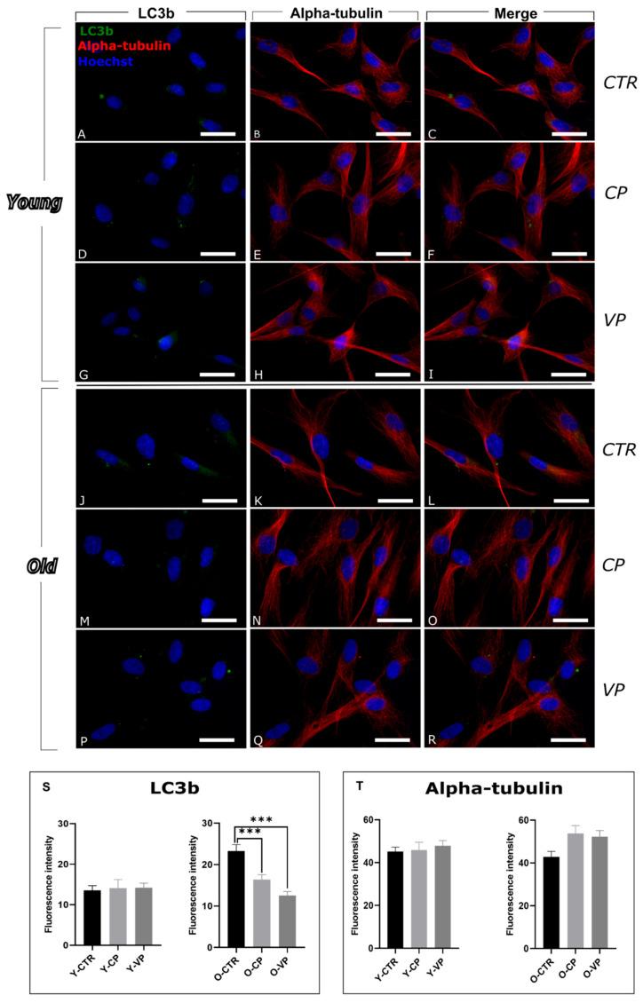 https://cdn.ncbi.nlm.nih.gov/pmc/blobs/52c7/12251965/9150675bc1c5/nutrients-17-02147-g002.jpg