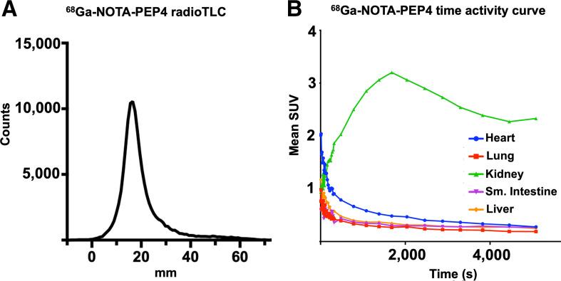 https://cdn.ncbi.nlm.nih.gov/pmc/blobs/5355/8612341/8dee80547692/jnm261768fig3.jpg