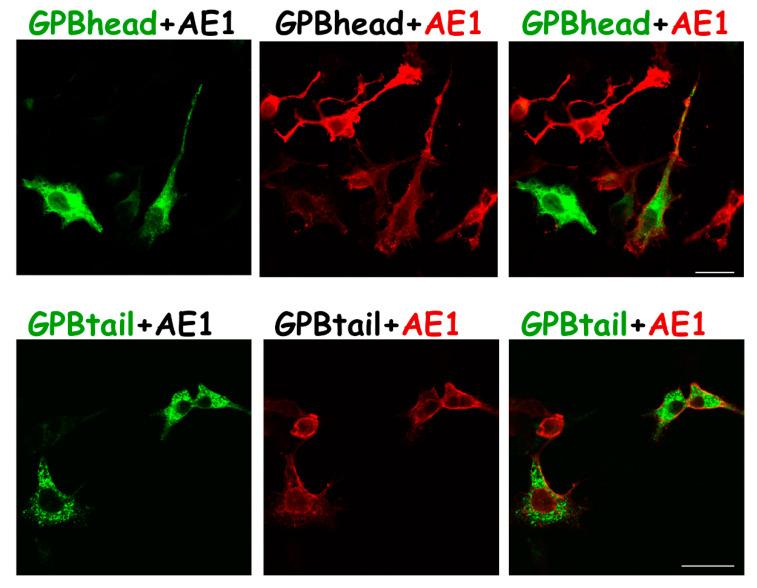 https://cdn.ncbi.nlm.nih.gov/pmc/blobs/5444/9653601/6190e9d71c47/cells-11-03512-g006.jpg