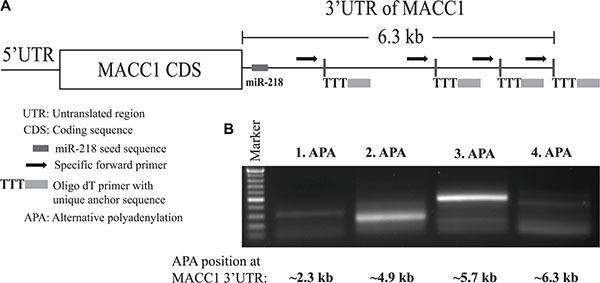 https://cdn.ncbi.nlm.nih.gov/pmc/blobs/54a2/5288198/bea4157c5e5e/oncotarget-07-53443-g008.jpg