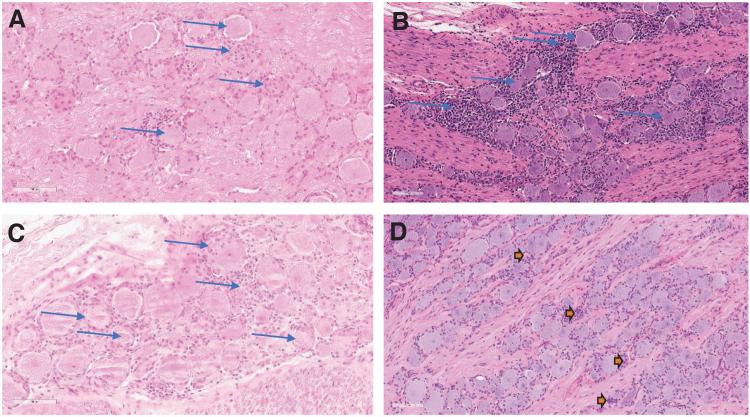 https://cdn.ncbi.nlm.nih.gov/pmc/blobs/55b2/9347375/b6d2891f2607/hum.2021.255_figure2.jpg