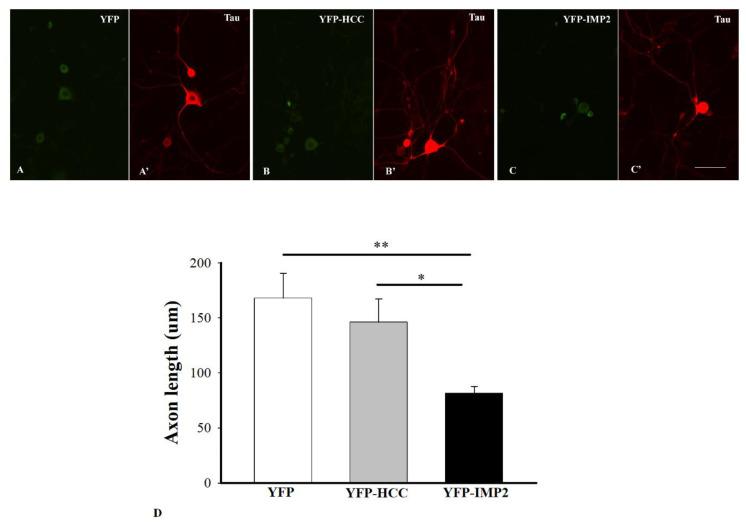 https://cdn.ncbi.nlm.nih.gov/pmc/blobs/56b1/8534607/a9501a28ee6a/cells-10-02654-g002.jpg