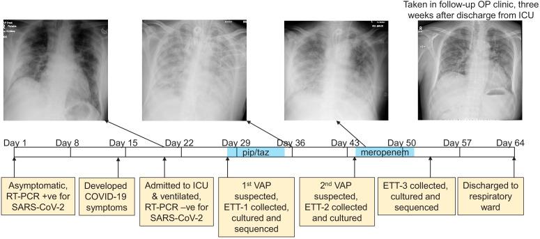 https://cdn.ncbi.nlm.nih.gov/pmc/blobs/5778/7775105/df88d03ebdd7/elife-63430-fig1.jpg