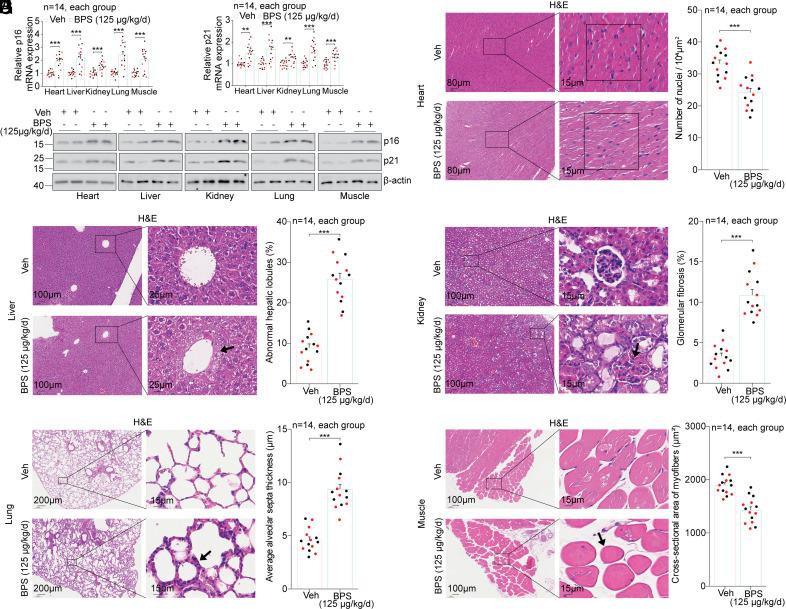 https://cdn.ncbi.nlm.nih.gov/pmc/blobs/5806/12167992/fe1723468257/pnas.2420437122fig03.jpg