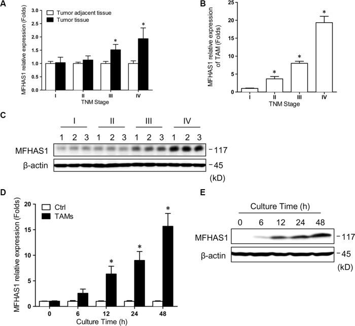 https://cdn.ncbi.nlm.nih.gov/pmc/blobs/5843/5346672/5bde973d4576/oncotarget-07-78726-g001.jpg