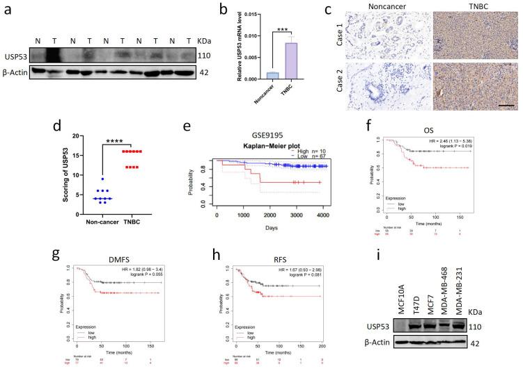 https://cdn.ncbi.nlm.nih.gov/pmc/blobs/59b6/10605207/82ac2729e58c/cancers-15-05033-g001.jpg