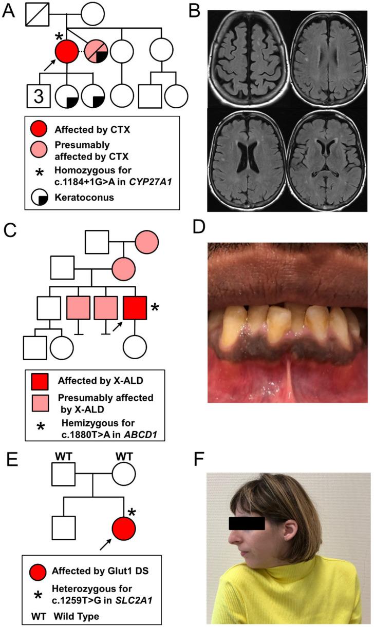 https://cdn.ncbi.nlm.nih.gov/pmc/blobs/5a00/8148126/bed15dfbcabb/genes-12-00695-g001.jpg