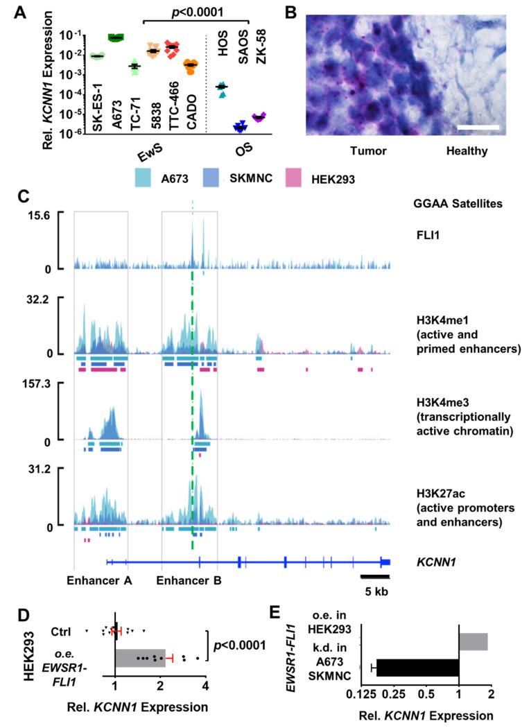 https://cdn.ncbi.nlm.nih.gov/pmc/blobs/5c0a/9564116/66b64bdb7502/cancers-14-04819-g002.jpg