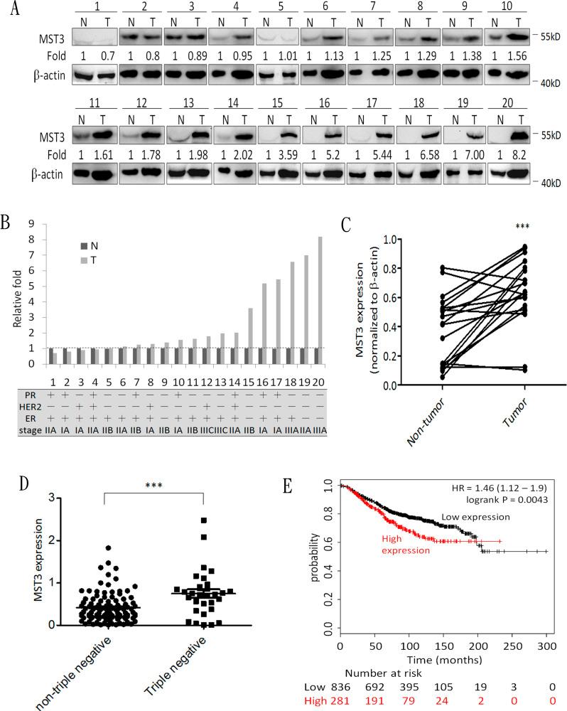 https://cdn.ncbi.nlm.nih.gov/pmc/blobs/5ee4/4924737/b390fd3093f7/oncotarget-07-14586-g001.jpg