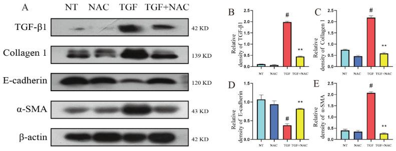 https://cdn.ncbi.nlm.nih.gov/pmc/blobs/5f29/9692329/7fcd4d07a2d3/metabolites-12-01035-g007.jpg
