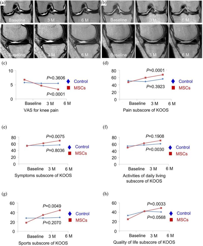 https://cdn.ncbi.nlm.nih.gov/pmc/blobs/6012/7457700/f52bcaedf3bb/10.1177_2041731420943839-fig1.jpg