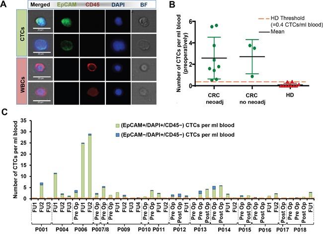 https://cdn.ncbi.nlm.nih.gov/pmc/blobs/6789/5356741/e6b9500ed5cf/oncotarget-07-85349-g003.jpg