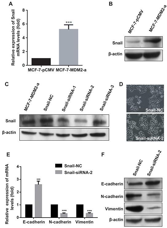 https://cdn.ncbi.nlm.nih.gov/pmc/blobs/6871/5095067/067cf50febda/oncotarget-07-37177-g005.jpg
