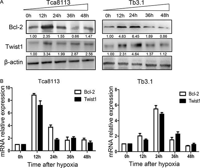 https://cdn.ncbi.nlm.nih.gov/pmc/blobs/6a43/5352356/ba60f4de7bdf/oncotarget-08-7729-g002.jpg