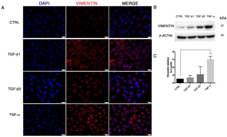 https://cdn.ncbi.nlm.nih.gov/pmc/blobs/6b26/7915105/a9665475f7c1/biomolecules-11-00226-g002.jpg