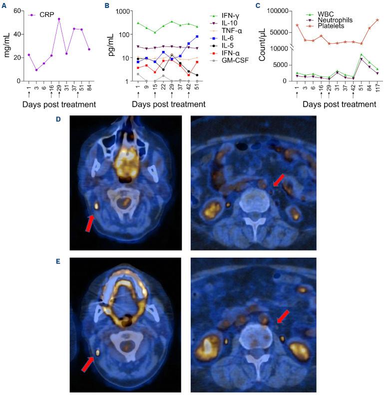 https://cdn.ncbi.nlm.nih.gov/pmc/blobs/6fab/11367231/21ac0104665b/1093037.fig3.jpg