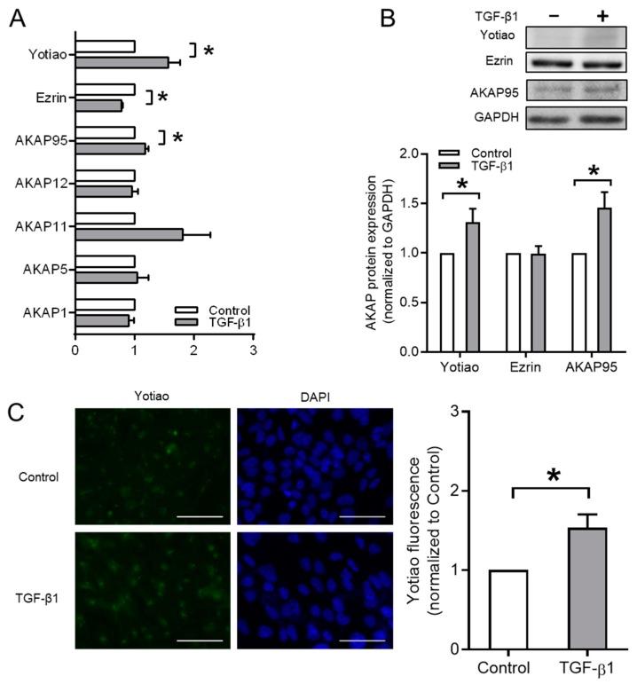https://cdn.ncbi.nlm.nih.gov/pmc/blobs/71dc/7072527/c5656905fb6b/cells-09-00356-g004.jpg