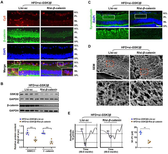 https://cdn.ncbi.nlm.nih.gov/pmc/blobs/7344/7377872/ffd5a1de7703/aging-12-103446-g005.jpg
