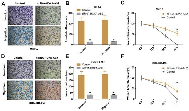 https://cdn.ncbi.nlm.nih.gov/pmc/blobs/76c9/5542252/c1b04ad0a255/oncotarget-08-46090-g003.jpg