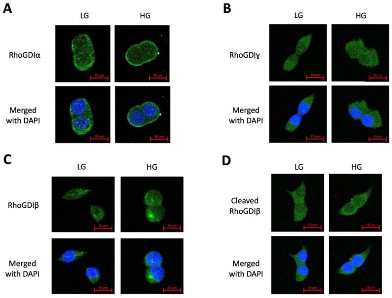 https://cdn.ncbi.nlm.nih.gov/pmc/blobs/7807/10854874/31b1df6d4797/cells-13-00272-g005.jpg
