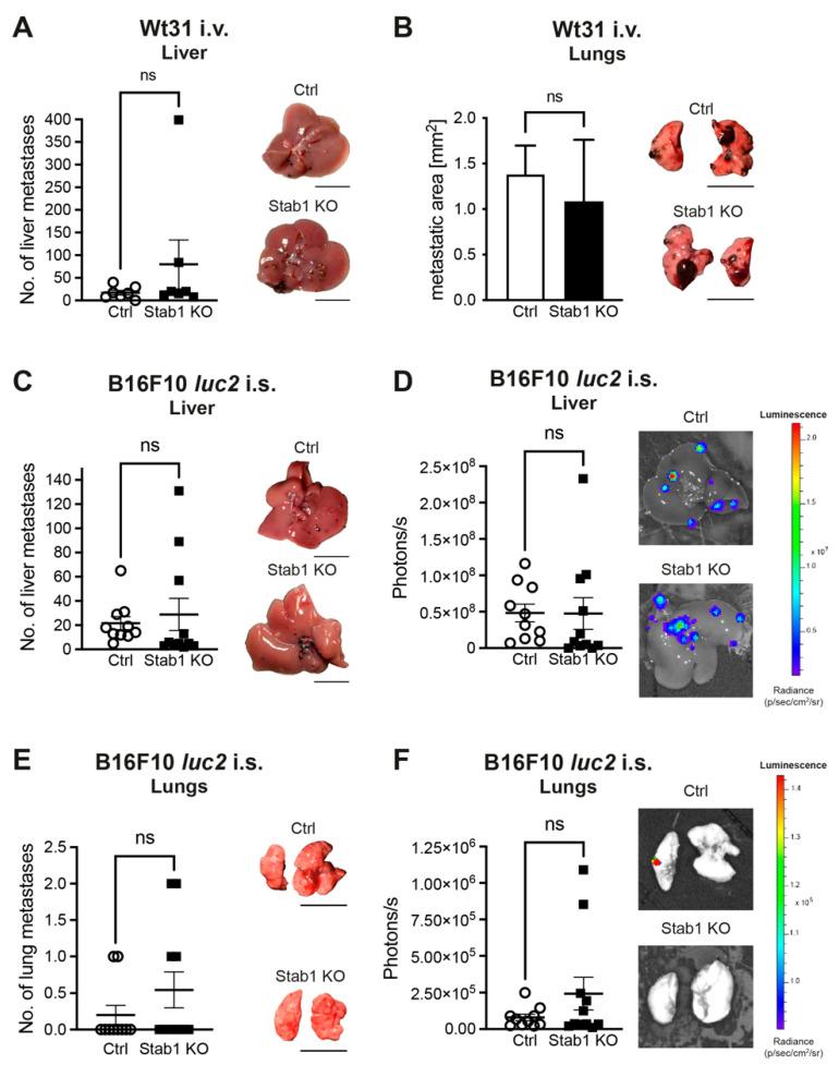 https://cdn.ncbi.nlm.nih.gov/pmc/blobs/79a8/10814973/5797bb407a82/cancers-16-00441-g001.jpg