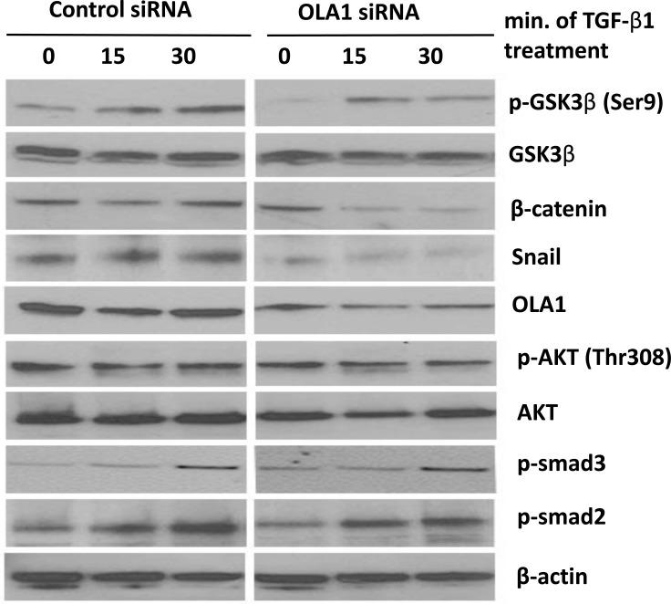 https://cdn.ncbi.nlm.nih.gov/pmc/blobs/7c09/4891128/6f601c22eff1/oncotarget-07-10402-g005.jpg