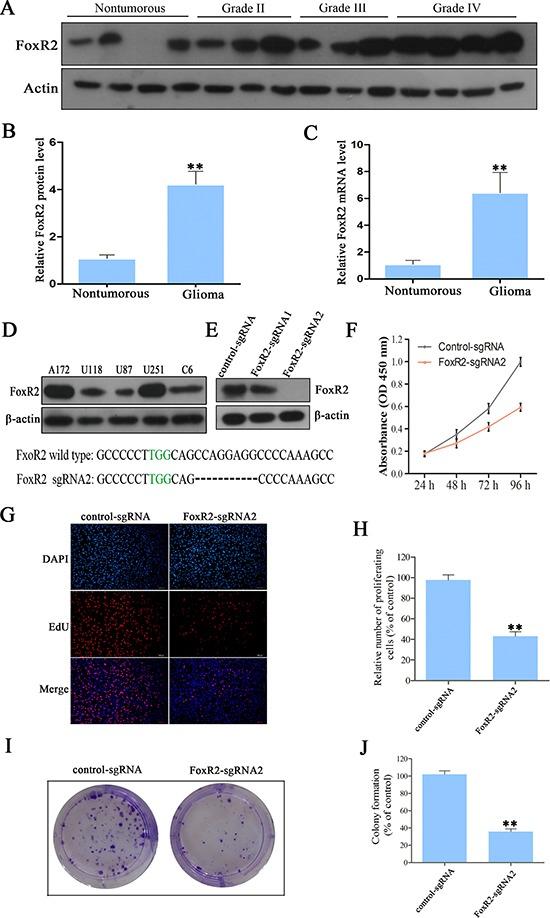 https://cdn.ncbi.nlm.nih.gov/pmc/blobs/7dd5/5593559/781a22f24e67/oncotarget-08-56255-g001.jpg