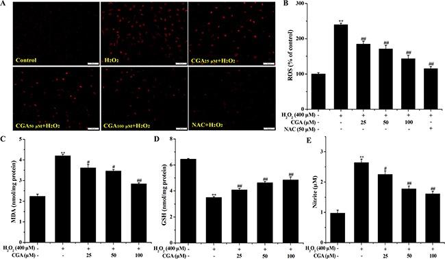https://cdn.ncbi.nlm.nih.gov/pmc/blobs/7e07/5362435/e820bd7d3513/oncotarget-08-14680-g004.jpg