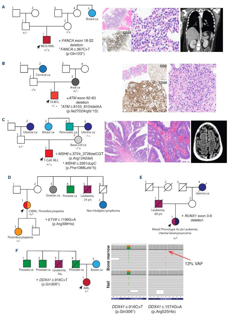 https://cdn.ncbi.nlm.nih.gov/pmc/blobs/7f79/11443390/a90a8b2afd48/1093383.fig2.jpg