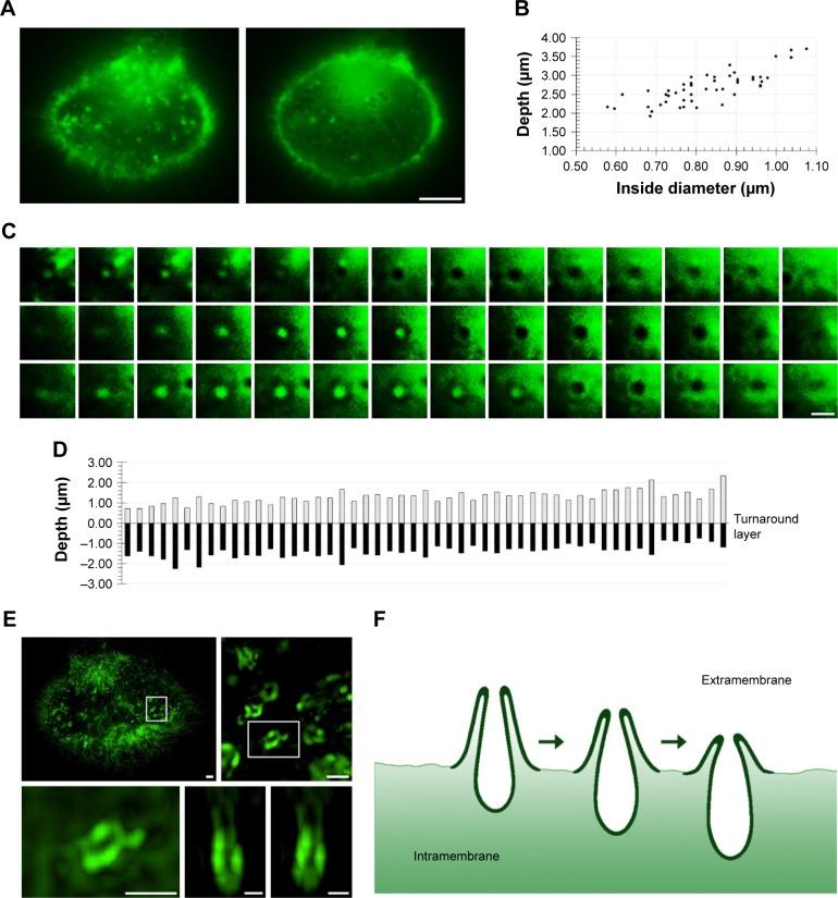 https://cdn.ncbi.nlm.nih.gov/pmc/blobs/8382/6143643/834cf8e8a9d4/ijn-13-5321Fig3.jpg