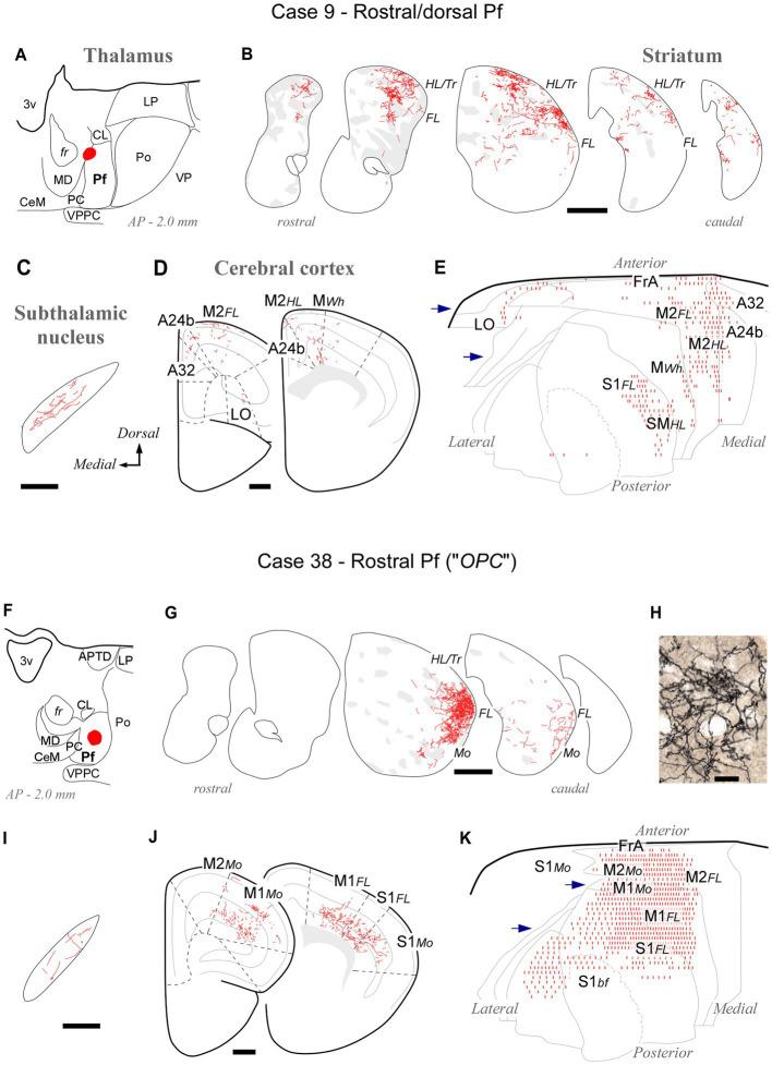 https://cdn.ncbi.nlm.nih.gov/pmc/blobs/861f/10800635/1b07a4c45ea0/fnana-17-1305500-g006.jpg