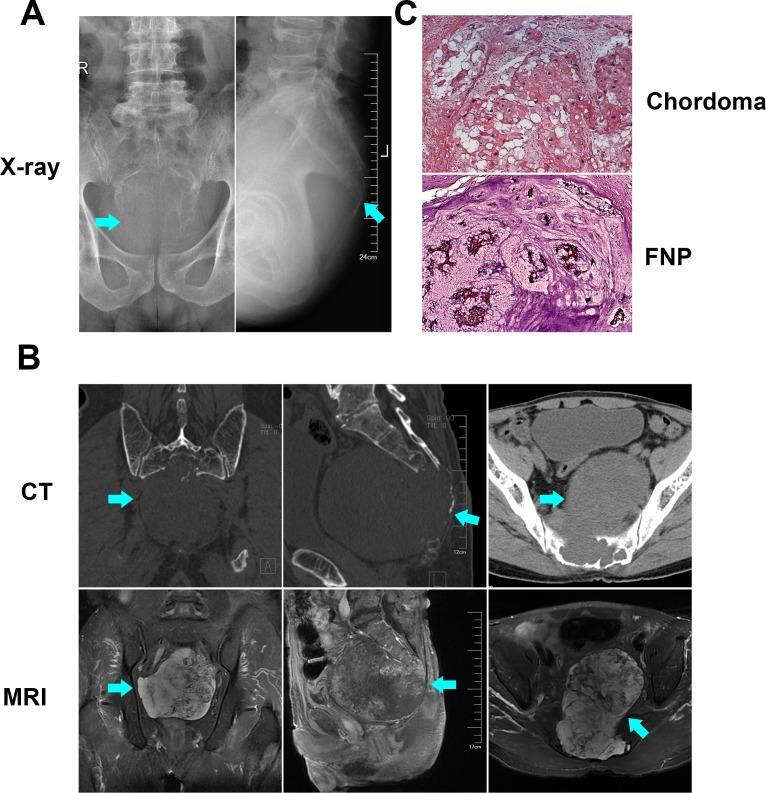 https://cdn.ncbi.nlm.nih.gov/pmc/blobs/88ce/5762536/41d1a67fe321/oncotarget-08-112623-g001.jpg
