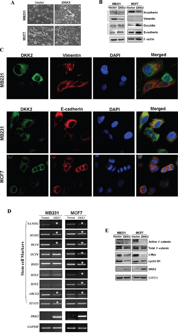 https://cdn.ncbi.nlm.nih.gov/pmc/blobs/88ee/5503624/a6d9bdbac2e1/oncotarget-08-39443-g008.jpg