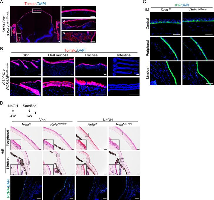 https://cdn.ncbi.nlm.nih.gov/pmc/blobs/89f3/8192125/14f4920d7f61/elife-67315-fig1-figsupp2.jpg