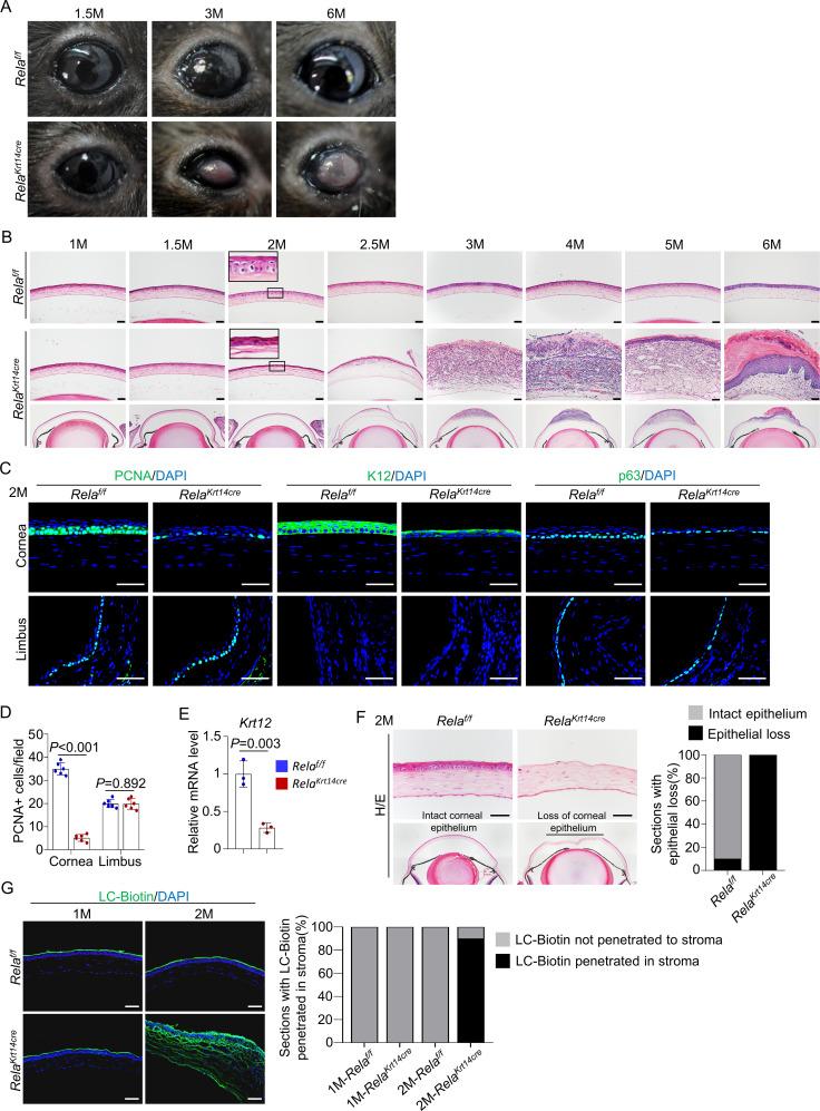 https://cdn.ncbi.nlm.nih.gov/pmc/blobs/89f3/8192125/7d716fd95602/elife-67315-fig2.jpg