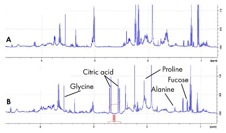 https://cdn.ncbi.nlm.nih.gov/pmc/blobs/8ad5/8469343/181f0db2da38/metabolites-11-00587-g002.jpg