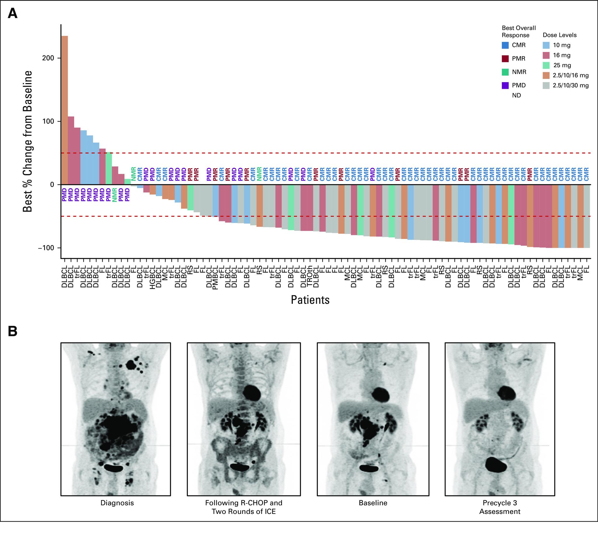 https://cdn.ncbi.nlm.nih.gov/pmc/blobs/8ce8/8210975/efe178b6b1f6/jco-39-1959-g005.jpg