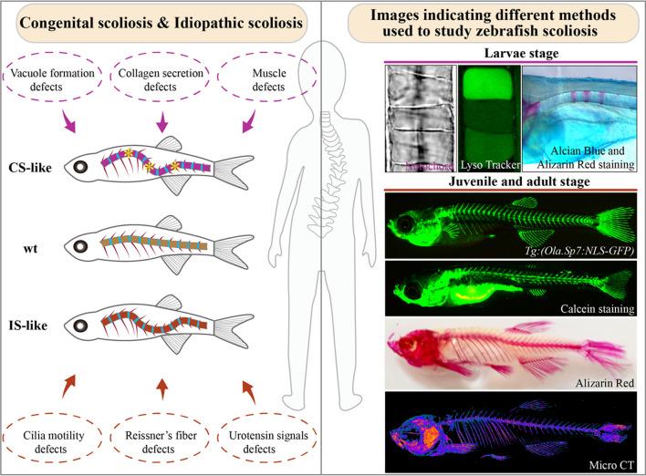 https://cdn.ncbi.nlm.nih.gov/pmc/blobs/8d38/9441191/d0dbdb222649/18_2022_4534_Fig1_HTML.jpg