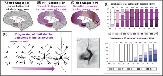 https://cdn.ncbi.nlm.nih.gov/pmc/blobs/8dac/12326325/5c192a3699aa/ALZ-21-e70404-g008.jpg