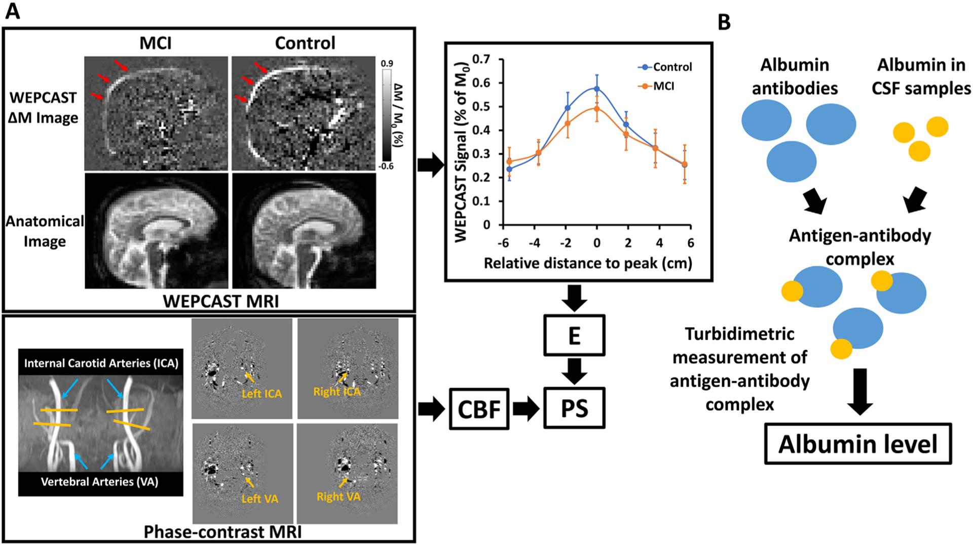 https://cdn.ncbi.nlm.nih.gov/pmc/blobs/8dbf/8805295/98f6d9e34e65/nihms-1773734-f0001.jpg