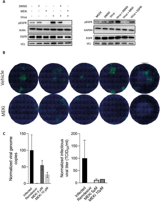 https://cdn.ncbi.nlm.nih.gov/pmc/blobs/8fc7/10320016/cdf6453ab860/LSA-2022-01880_FigS5.jpg