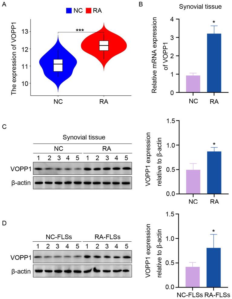 https://cdn.ncbi.nlm.nih.gov/pmc/blobs/9874/12327419/a5ef8c255ec0/JIR-18-10341-g0003.jpg