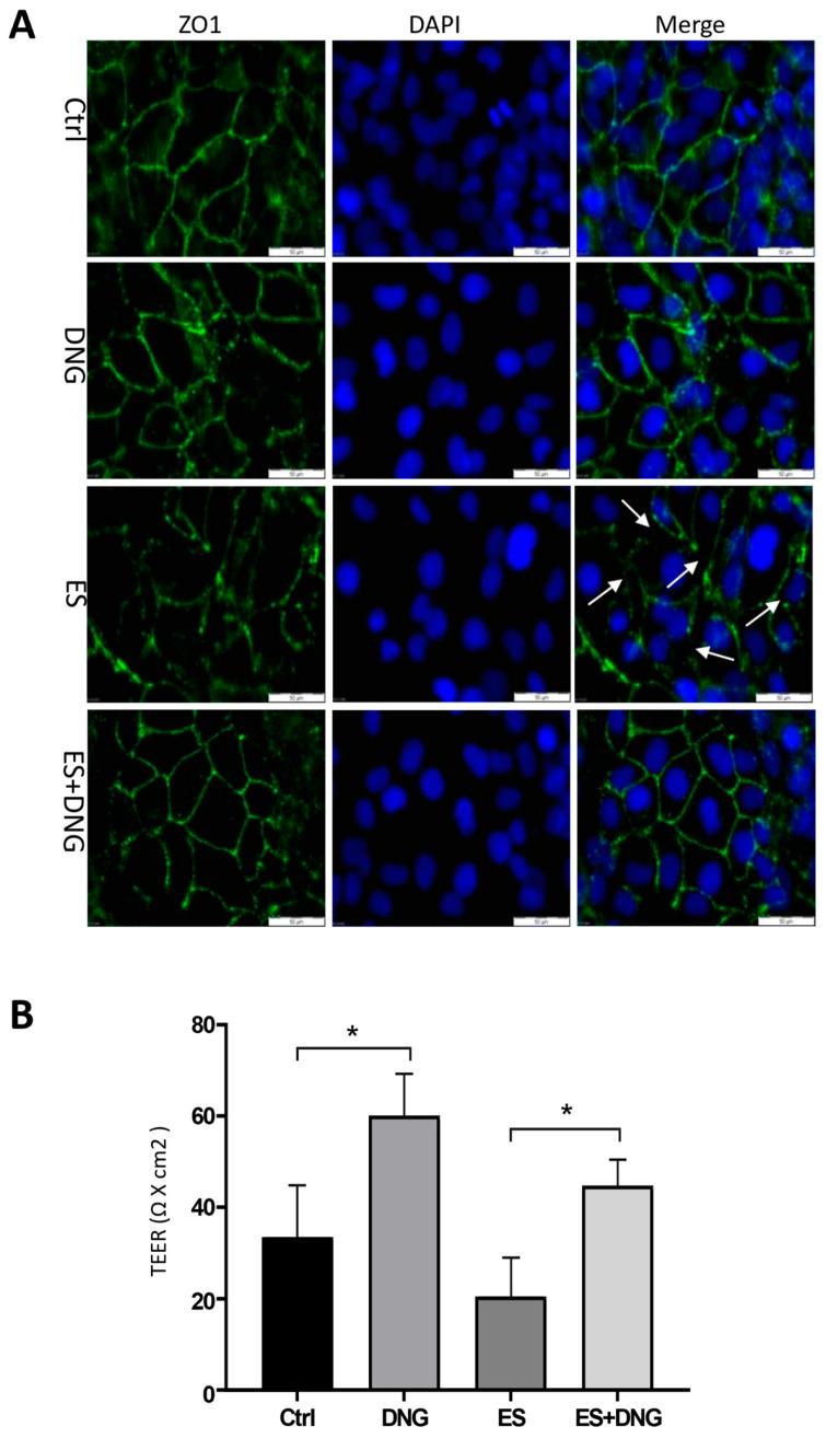 https://cdn.ncbi.nlm.nih.gov/pmc/blobs/9a28/11120542/10162b1a44ee/cells-13-00811-g005.jpg