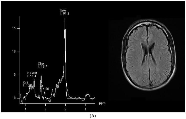 https://cdn.ncbi.nlm.nih.gov/pmc/blobs/9a95/11048612/e0a66fe8e7b9/brainsci-14-00337-g001a.jpg