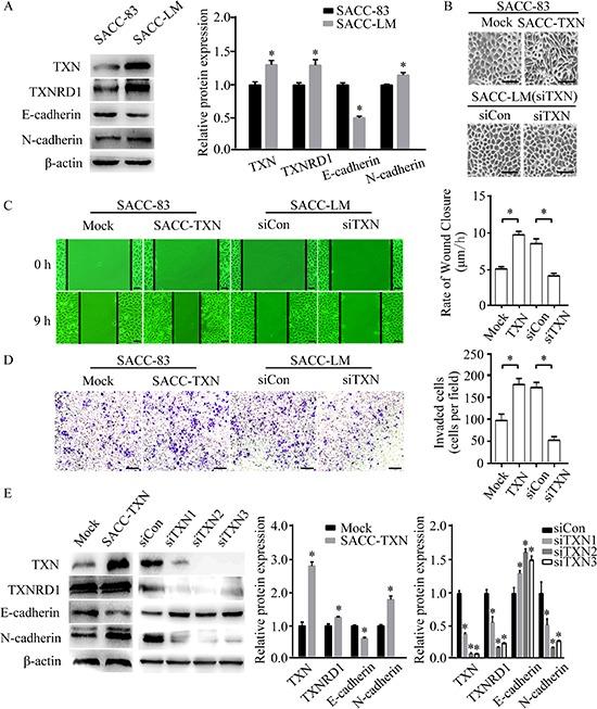 https://cdn.ncbi.nlm.nih.gov/pmc/blobs/9bf2/4694848/22e6738169a3/oncotarget-06-25506-g003.jpg